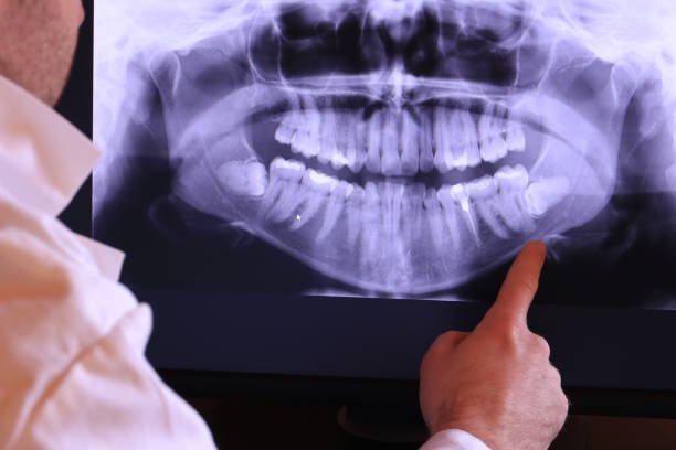 Best Dental Abscess Treatment in Cumberland Head, NY