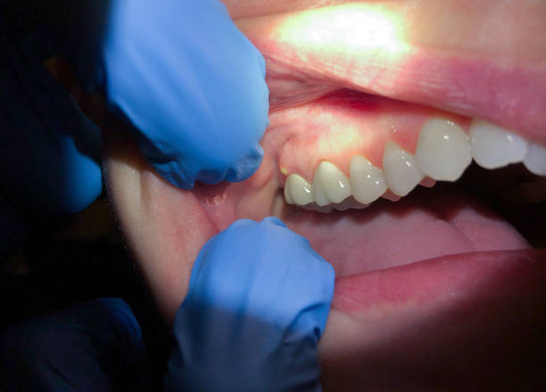 Best After-Hours Dental Care in Cumberland Head, NY