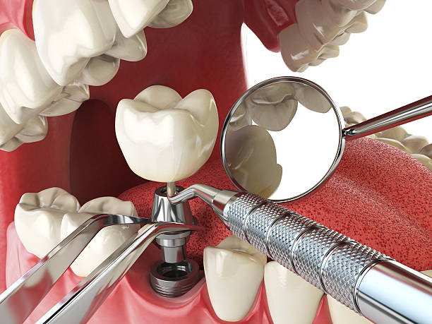 Best After-Hours Dental Care in Cumberland Head, NY